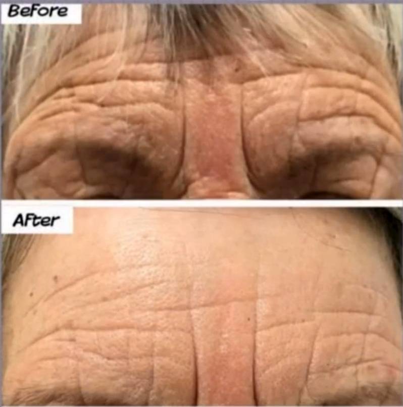 daffodil plasma pro 5 lr